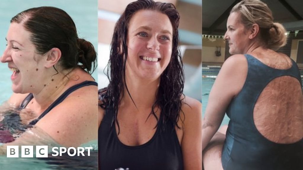 Mental Health: How swimming improved the lives of three women Mental Health: How swimming improved the lives of three women