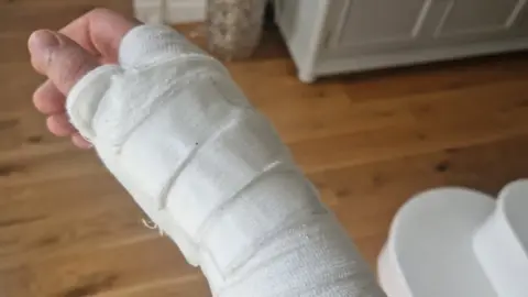 PSNI Injured hand