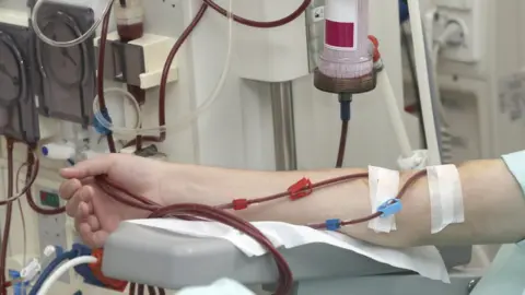 Getty Images A person receiving dialysis