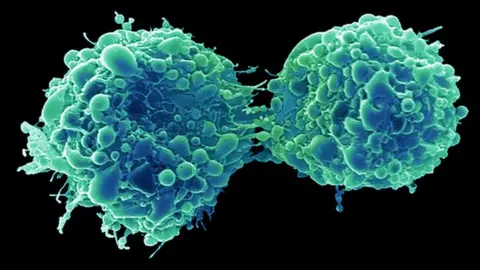 Science Photo Library Dividing bladder cancer cells
