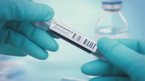 Getty Images Conoravirus test-tube