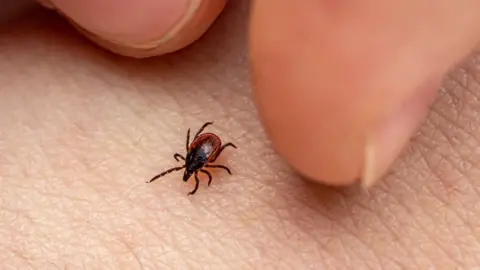 Getty Images A tick resting on a human palm