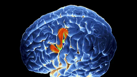 Several areas of the brain are involved when the interpreters are working in real time (SPL)