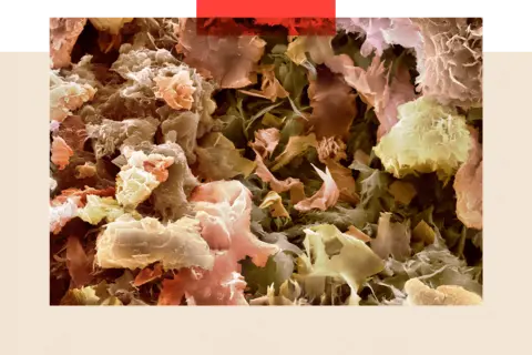 A fatberg under microscope which looks similar a shredded sponge-like consistency in different shades of yellow and pink