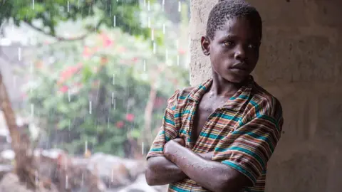 Sala Lewis/World Bank Boy sheltering from the rain