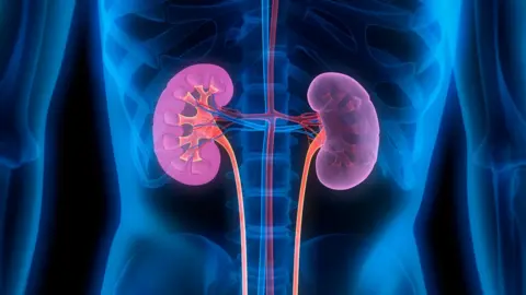 Getty Images An artistic rendering of an x-ray showing two kidneys