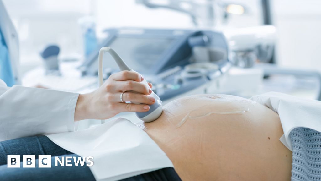 Maternity unit’s improvements ‘on track’ after damning report Maternity unit’s improvements ‘on track’ after damning report