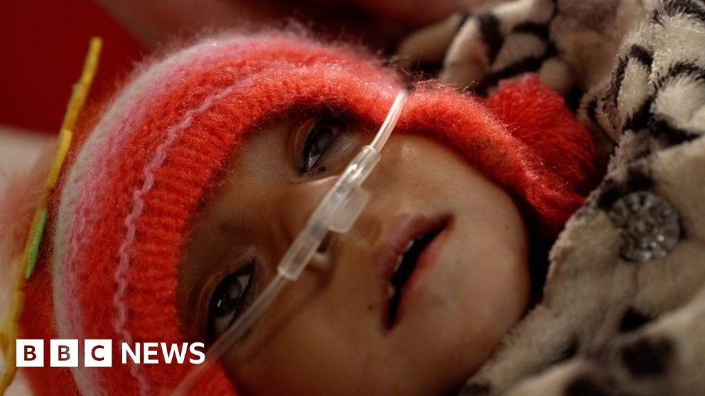 The tragedy of Afghanistan’s malnourished children The tragedy of Afghanistan’s malnourished children